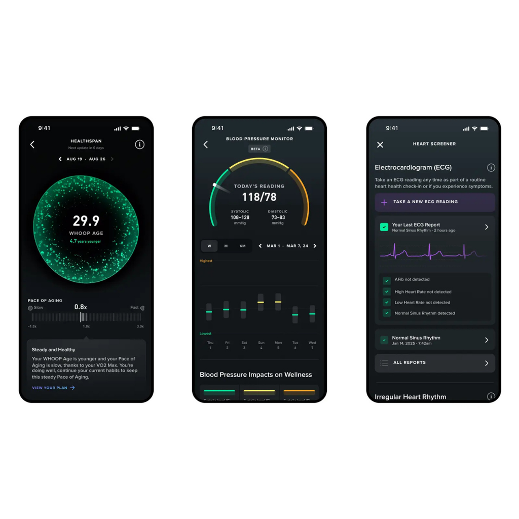 Whoop Mg Device (12 Month LIFE Subscription Included)